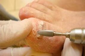 Mechanische Nagelplatte